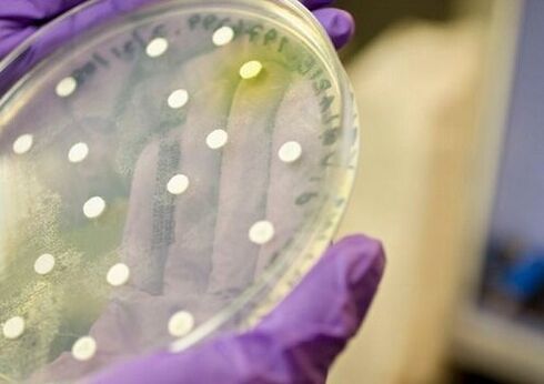 Coltura batterica per la diagnosi della prostatite